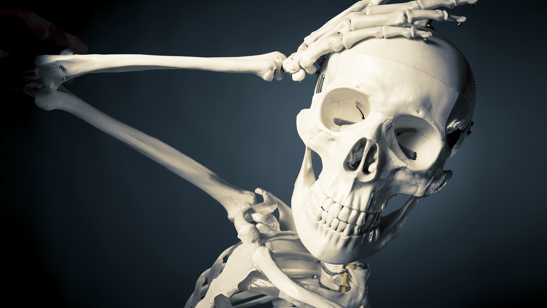 What would happen if you didn't have a skull?
