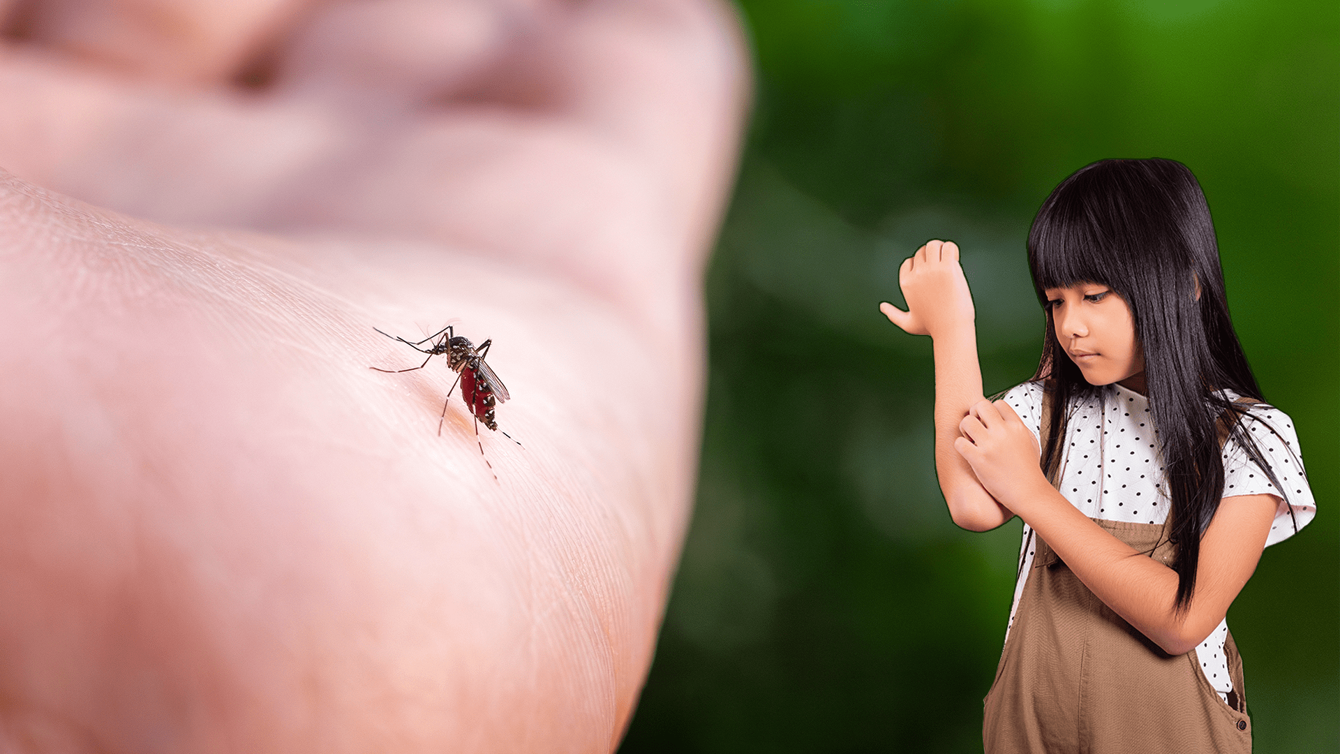 Why do bug bites itch?