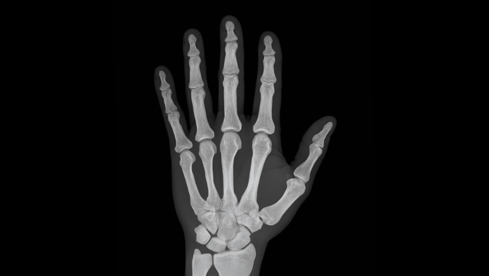 Why do our skeletons have so many bones? - Mystery Science